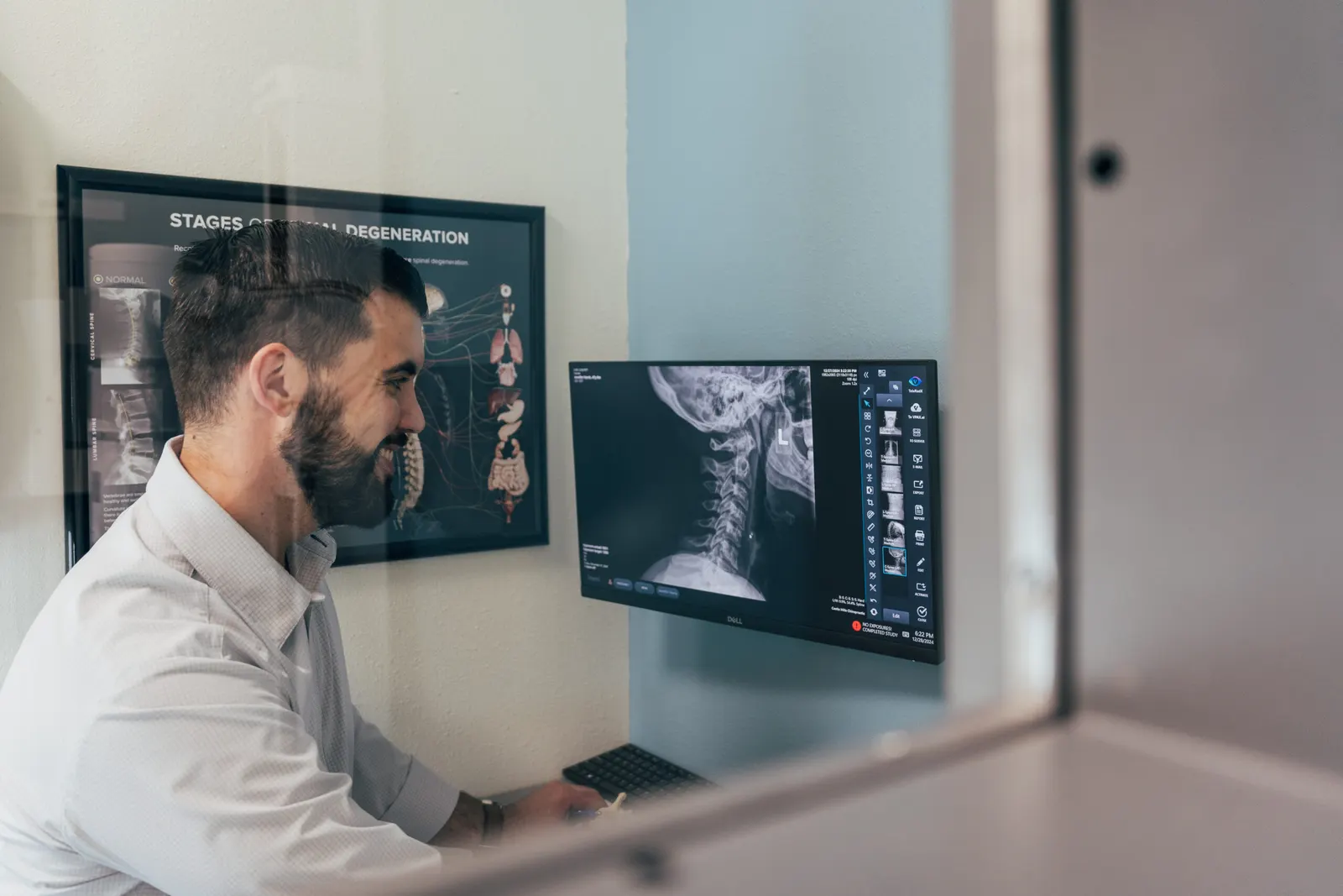 Dr Brent Johnson showing the spine X-ray
